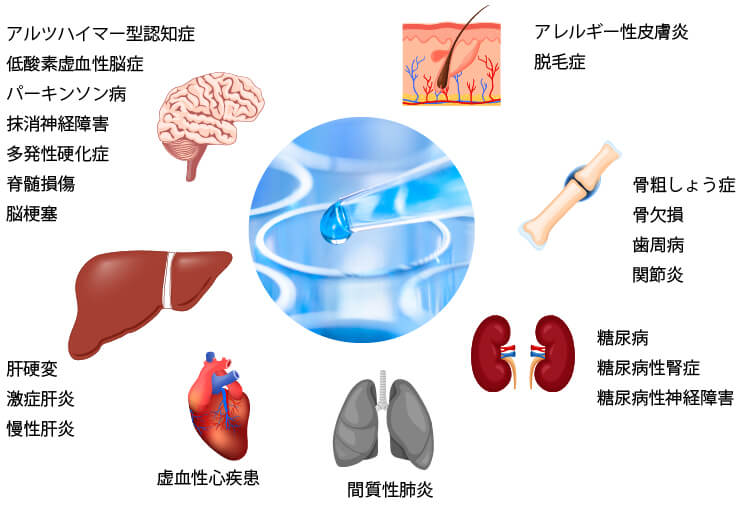 幹細胞培養上清液（エクソソーム療法）で効果が期待できる疾患