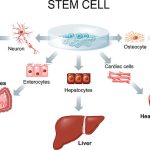 幹細胞治療と糖尿病