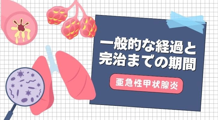 亜急性甲状腺炎の一般的な経過と完治までの期間