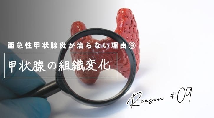 亜急性甲状腺炎がなかなか治らない理由⑨甲状腺の組織変化