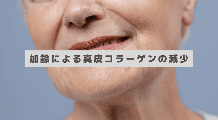 加齢による真皮コラーゲンの減少でほうれい線が出来る