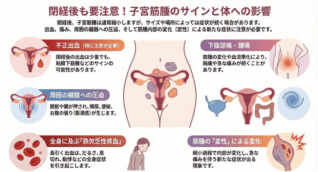 閉経後も続く子宮筋腫の症状と特徴