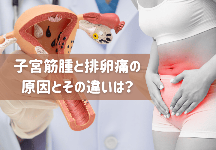 子宮筋腫と排卵痛の原因とその違いは?