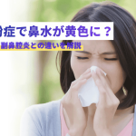 花粉症で鼻水が黄色に？考えられる原因と副鼻腔炎との違いを解説