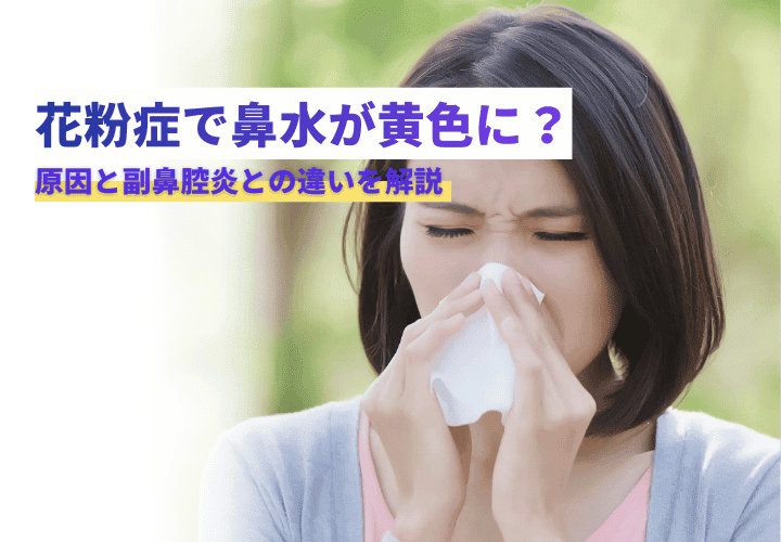 花粉症で鼻水が黄色に？考えられる原因と副鼻腔炎との違いを解説